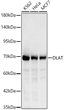 DLAT Antibody in Western Blot (WB)
