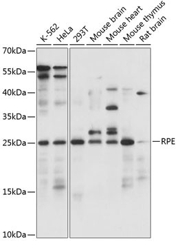 Ribulose-phosphate 3-epimerase Antibody in Western Blot (WB)