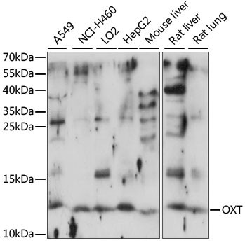 Oxytocin Antibody in Western Blot (WB)