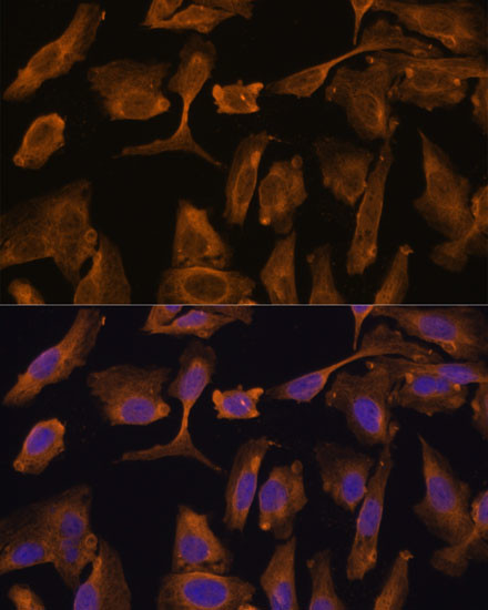 MTMR4 Antibody in Immunocytochemistry (ICC/IF)