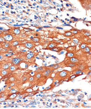 IQGAP2 Antibody in Immunohistochemistry (Paraffin) (IHC (P))