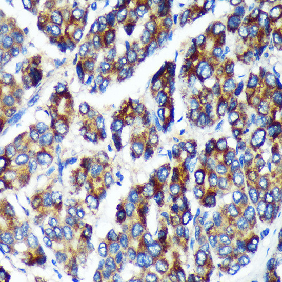 PLEKHB2 Antibody in Immunohistochemistry (Paraffin) (IHC (P))