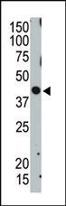 TSG101 Antibody in Western Blot (WB)