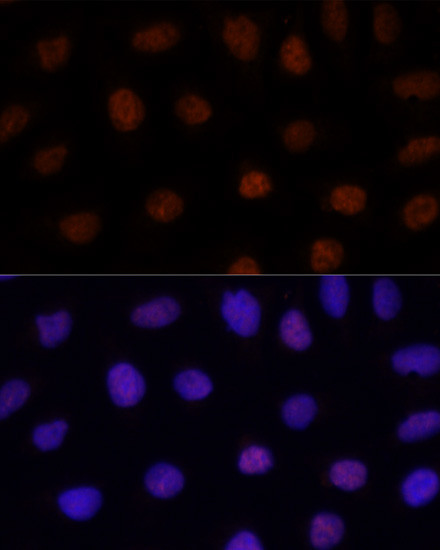 GLI2 Antibody in Immunocytochemistry (ICC/IF)