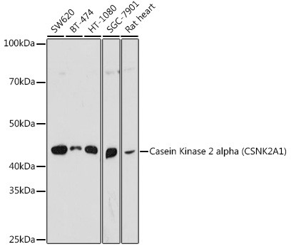 CK2 alpha-1 Antibody in Western Blot (WB)