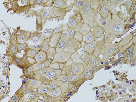 GGT1 Antibody in Immunohistochemistry (Paraffin) (IHC (P))