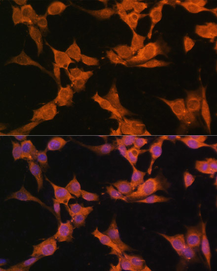 CaMKII alpha Antibody in Immunocytochemistry (ICC/IF)