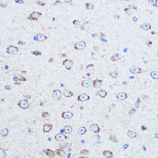 Reelin Antibody in Immunohistochemistry (Paraffin) (IHC (P))