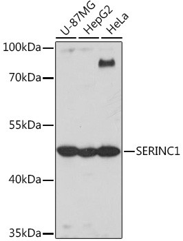 SERC1 Antibody in Western Blot (WB)