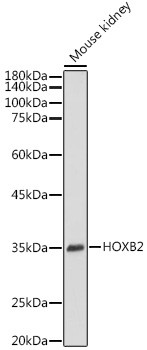 HOXB2 Antibody in Western Blot (WB)