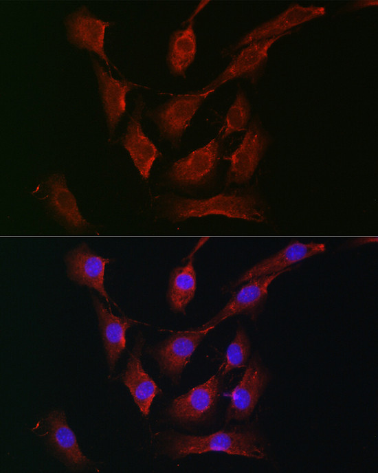 RSK1/RSK2/RSK3 Antibody in Immunocytochemistry (ICC/IF)