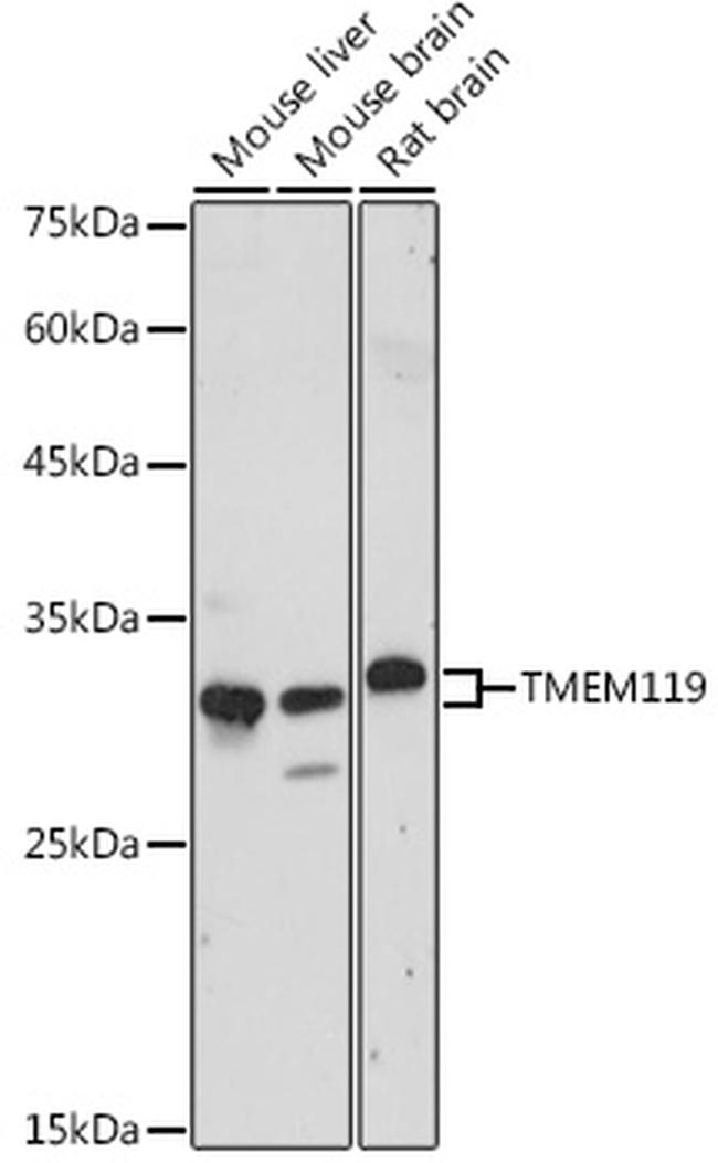 TMEM119 Polyclonal Antibody (PA5-120705)