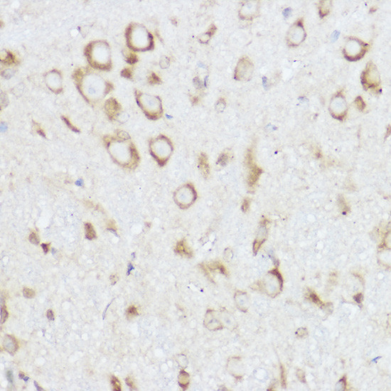 NEURL1B Antibody in Immunohistochemistry (Paraffin) (IHC (P))