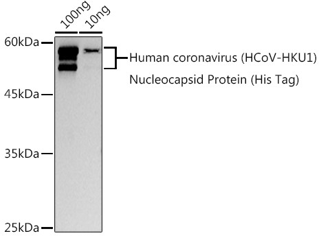 HCoV-HKU1 Nucleoprotein Antibody in Western Blot (WB)