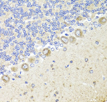 TrkA Antibody in Immunohistochemistry (Paraffin) (IHC (P))