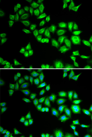 Cullin 1 Antibody in Immunocytochemistry (ICC/IF)