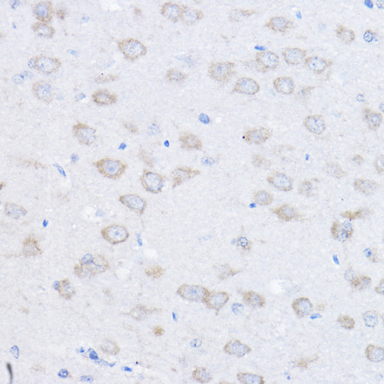 UBE4A Antibody in Immunohistochemistry (Paraffin) (IHC (P))