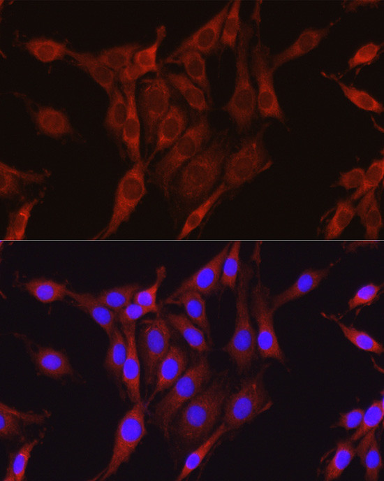 Glutamine Synthetase Antibody in Immunocytochemistry (ICC/IF)