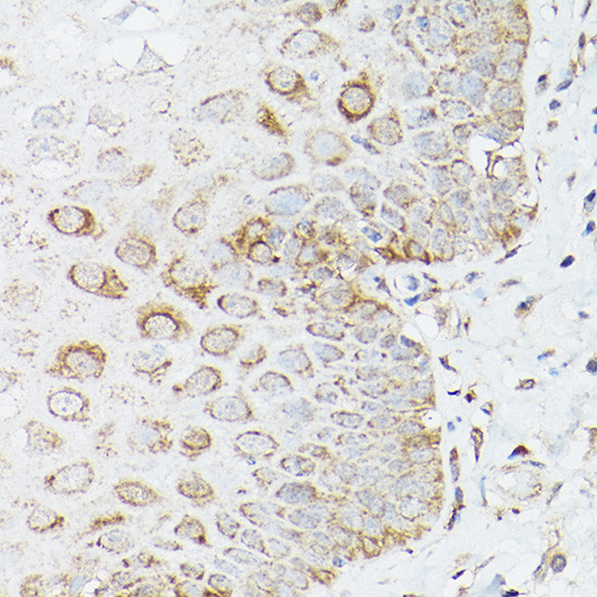 Glutamine Synthetase Antibody in Immunohistochemistry (Paraffin) (IHC (P))