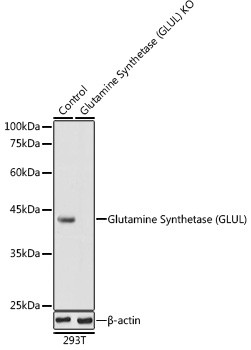 Glutamine Synthetase Antibody in Western Blot (WB)