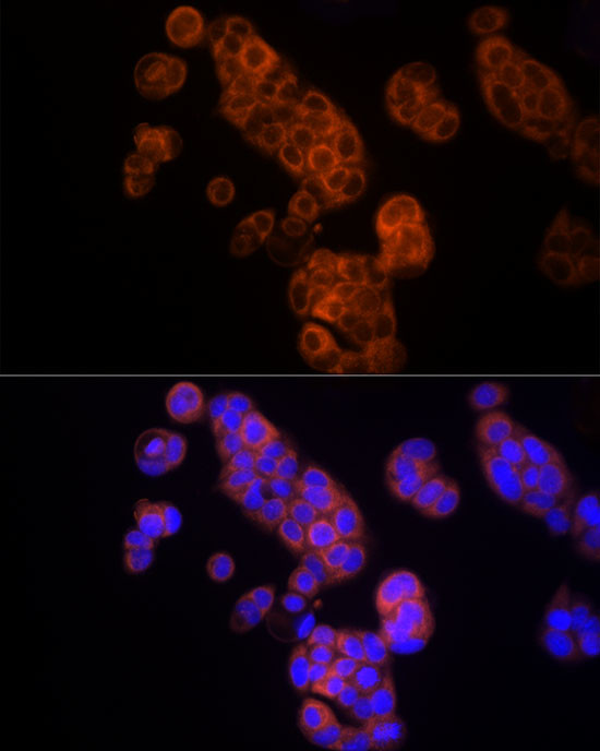 TK1 Antibody in Immunocytochemistry (ICC/IF)