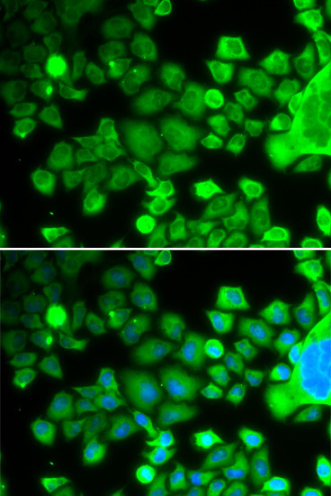 RPS10 Antibody in Immunocytochemistry (ICC/IF)