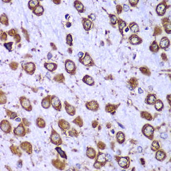 RPS10 Antibody in Immunohistochemistry (Paraffin) (IHC (P))