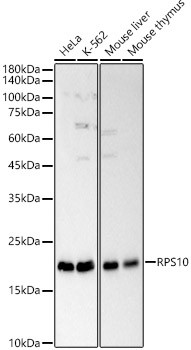 RPS10 Antibody in Western Blot (WB)