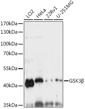 GSK3B Antibody in Western Blot (WB)