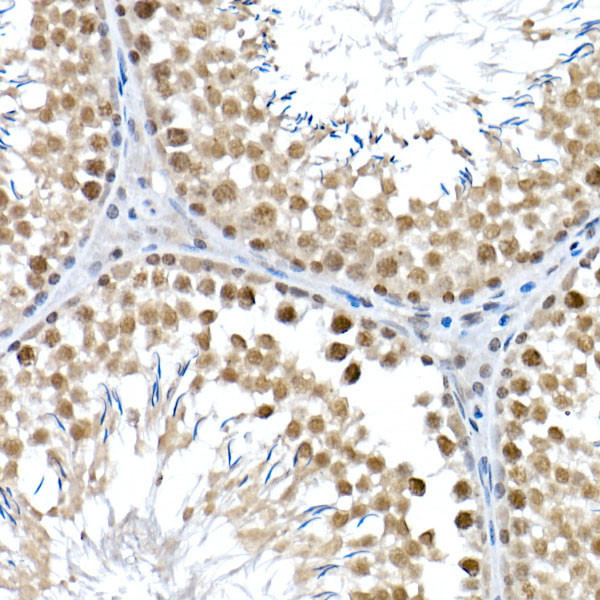 BAP1 Antibody in Immunohistochemistry (Paraffin) (IHC (P))