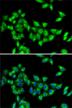 KIF3A Antibody in Immunocytochemistry (ICC/IF)