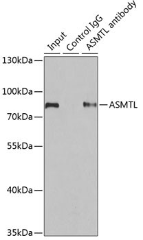 ASMTL Antibody in Immunoprecipitation (IP)