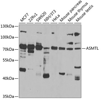 ASMTL Antibody in Western Blot (WB)