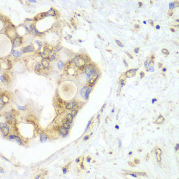 VTI1B Antibody in Immunohistochemistry (Paraffin) (IHC (P))