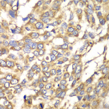 VTI1B Antibody in Immunohistochemistry (Paraffin) (IHC (P))