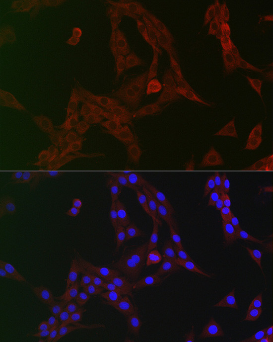 GCN2 Antibody in Immunocytochemistry (ICC/IF)