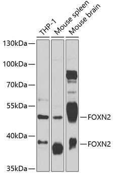 FOXN2 Antibody in Western Blot (WB)