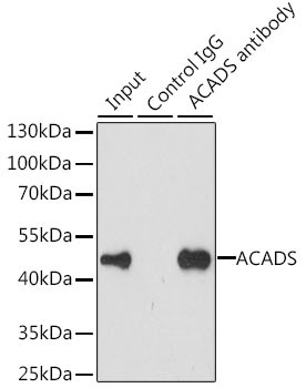 ACADS Antibody in Immunoprecipitation (IP)