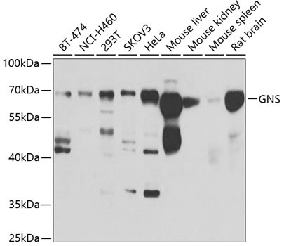 GNS Antibody in Western Blot (WB)