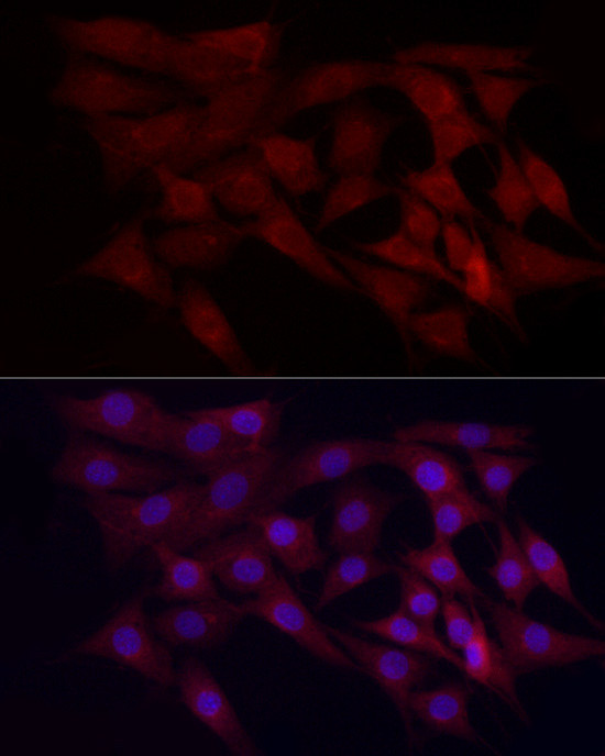 WDR45 Antibody in Immunocytochemistry (ICC/IF)