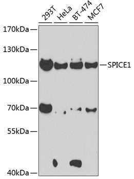 SPICE1 Antibody in Western Blot (WB)