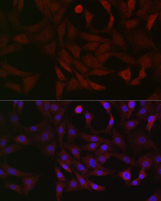 PFKP Antibody in Immunocytochemistry (ICC/IF)