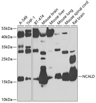 NCALD Antibody in Western Blot (WB)