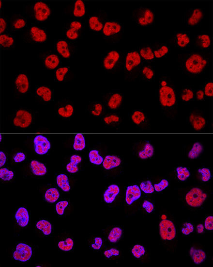 METTL3 Antibody in Immunocytochemistry (ICC/IF)