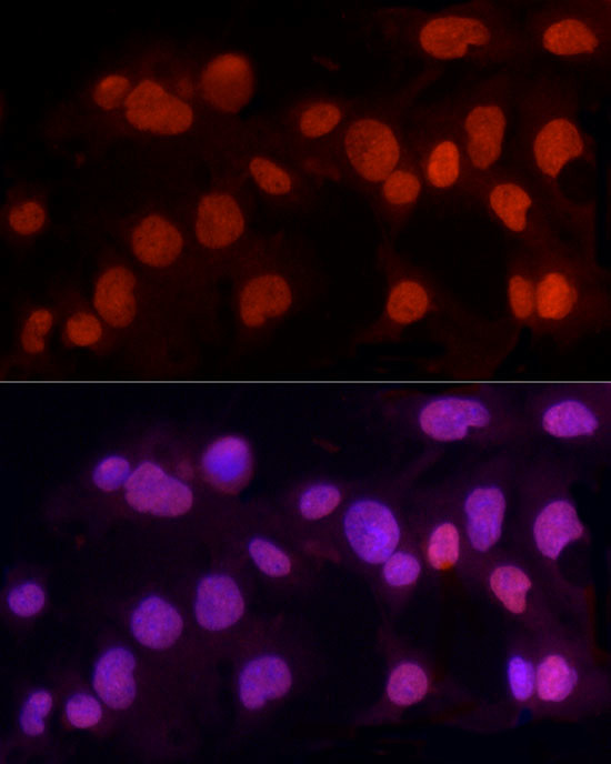 METTL3 Antibody in Immunocytochemistry (ICC/IF)