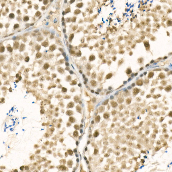 METTL3 Antibody in Immunohistochemistry (Paraffin) (IHC (P))