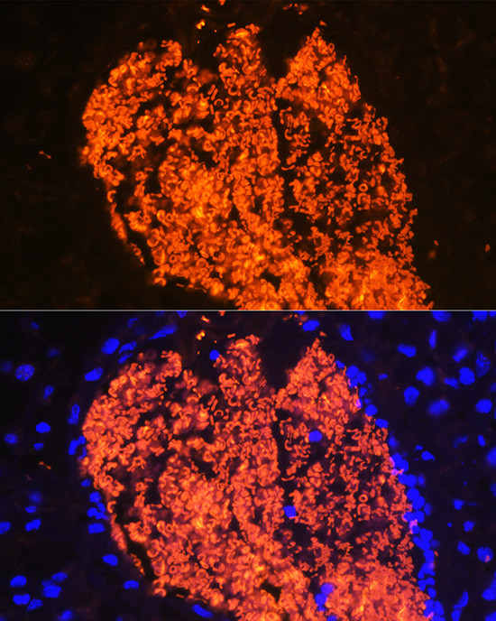 HBA2 Antibody in Immunohistochemistry (Paraffin) (IHC (P))