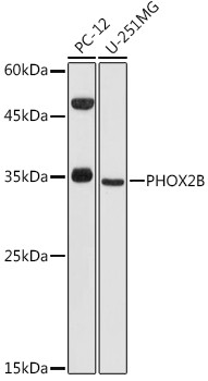 PHOX2B Antibody in Western Blot (WB)