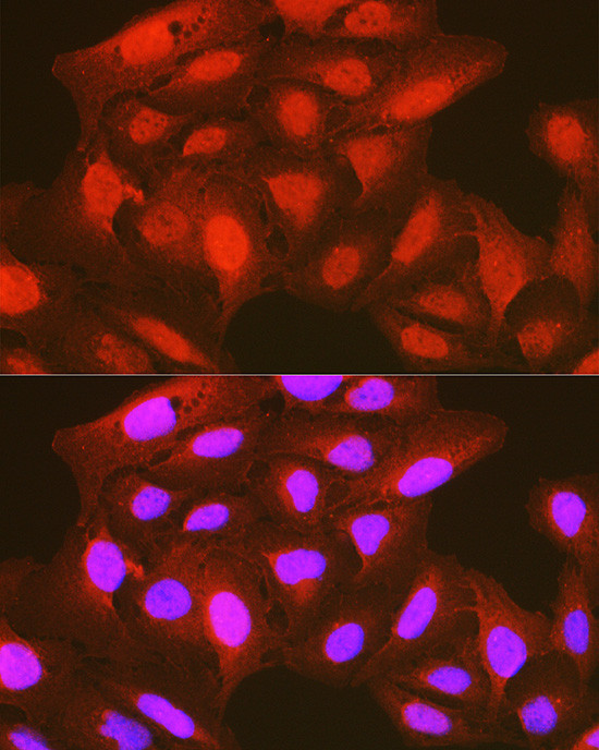 Phospho-PDPK1 (Ser241) Antibody in Immunocytochemistry (ICC/IF)