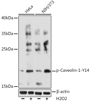 Phospho-Caveolin 1 (Tyr14) Antibody in Western Blot (WB)